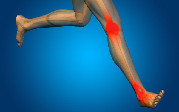 joint or articular pain, ache