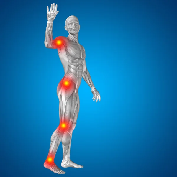 Anatomia com dor articular ou óssea . — Fotografia de Stock