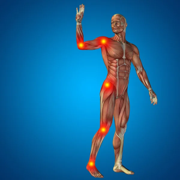 男性的关节或骨骼疼痛 — 图库照片