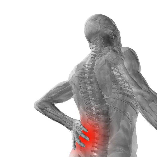 Man anatomy with back pain — Stock Photo, Image