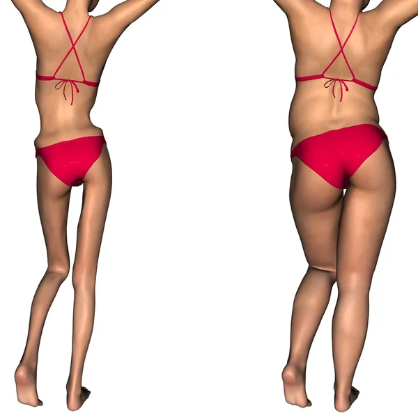 Anorexic Stock Photos, Royalty Free Anorexic Images ...
Obese Vs Anorexic
