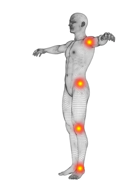 Περίγραμμα επιφάνειας σώματος με πόνο, πόνο στο o — Φωτογραφία Αρχείου
