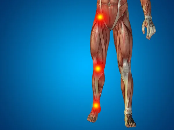 Joint or articular pain, ache or injury — Stock Photo, Image