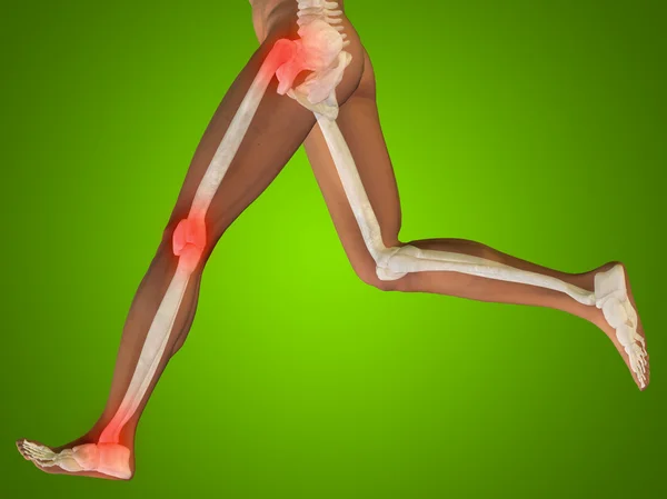 Joint or articular pain, ache — Stock Photo, Image