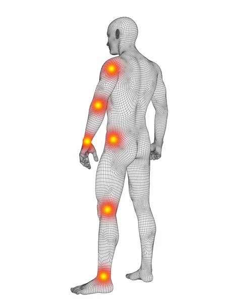 Cuerpo de alambre con dolor, dolor — Foto de Stock