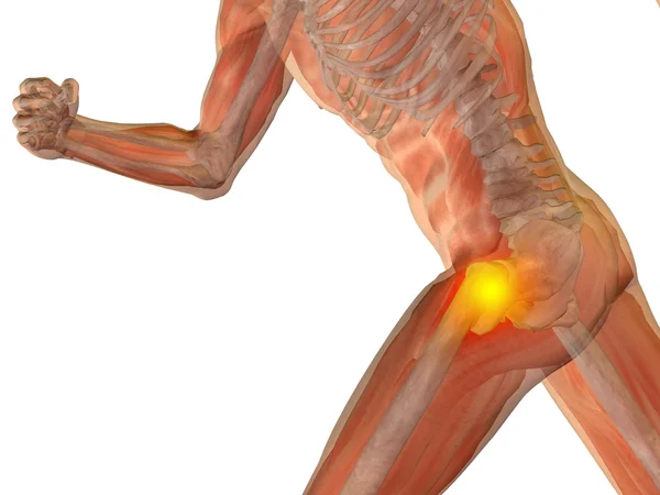 Joint or articular pain, ache or injury — Stock Photo, Image