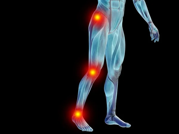 Human joint or articular pain, ache — 스톡 사진