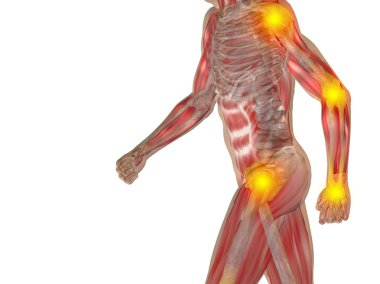 Kavramsal 3d insan anatomi veya sağlık tasarım, ortak ya da eklem ağrısı, ağrı ya da beyaz arka plan üzerinde izole yaralanma