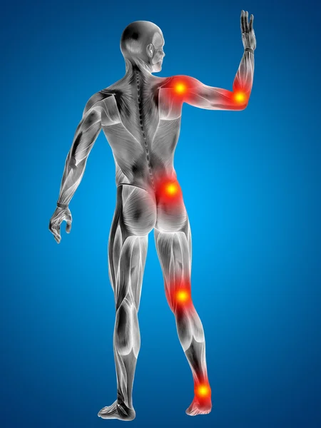 Man with muscles  with articular  pain — Stock Photo, Image