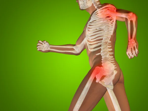 Conceptual 3D human man anatomy or health design, joint or articular pain, ache or injury over green gradient background — Stock Photo, Image