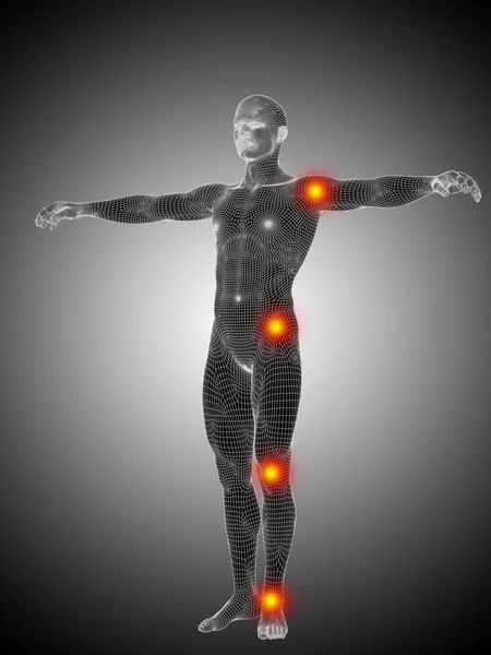 Konzept oder konzeptionelle 3D menschliche Anatomie Mesh oder Drahtgitter Körper mit Schmerz, Schmerz oder Entzündung über einem schwarz-weißen Hintergrund — Stockfoto
