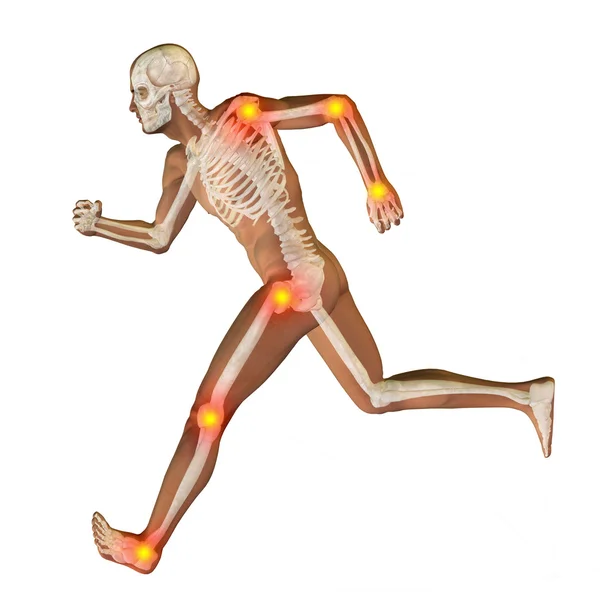 Joint or articular pain, ache — Stock Photo, Image