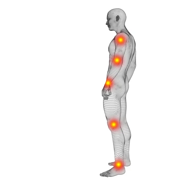 Wireframe lichaam met pijn, pijn — Stockfoto
