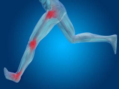 ortak veya eklem ağrısı, ağrı