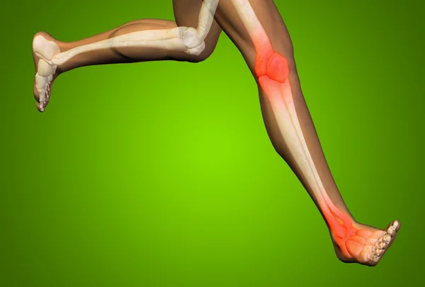 Joint or articular pain, ache — Stock Photo, Image