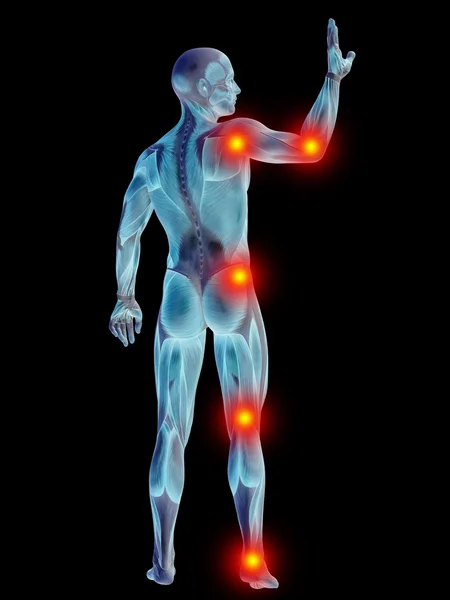 Human with articular or bones pain — Stock Photo, Image