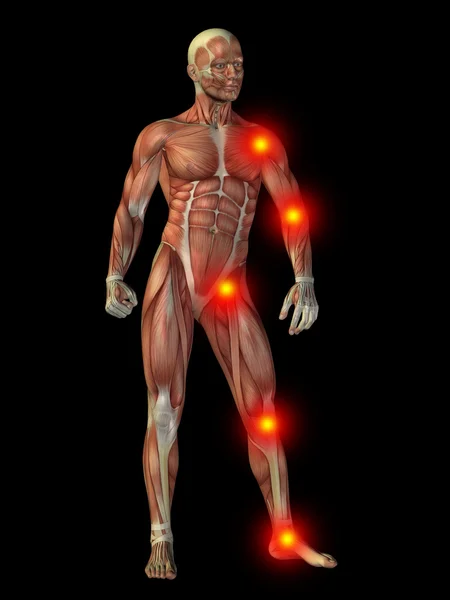 Humano con dolor articular o en los huesos — Foto de Stock