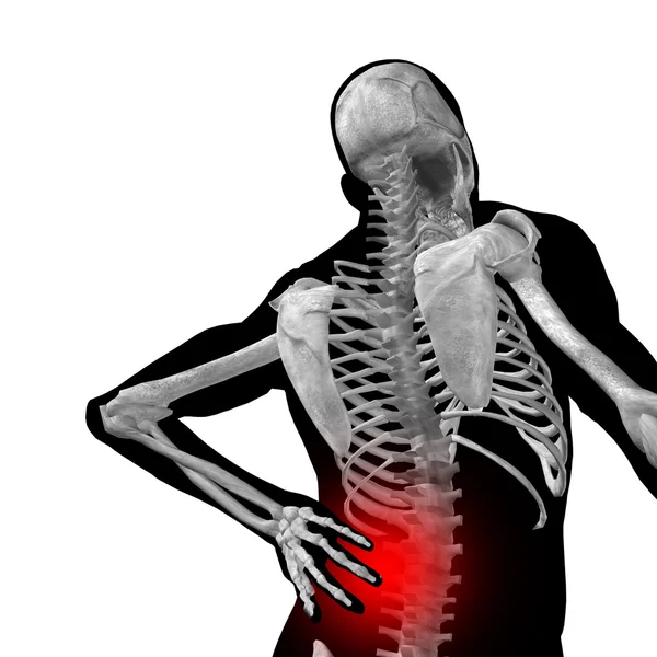 Man anatomy with back pain — Stock Photo, Image