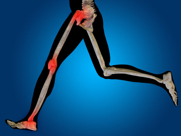 joint or articular pain, ache