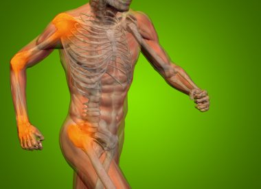 ortak veya eklem ağrısı, ağrı