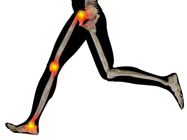 Joint or articular pain, ache — Stock Photo, Image