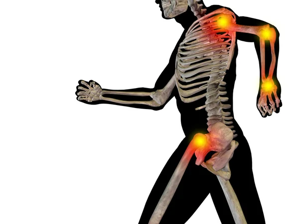Ortak veya eklem ağrısı, ağrı — Stok fotoğraf