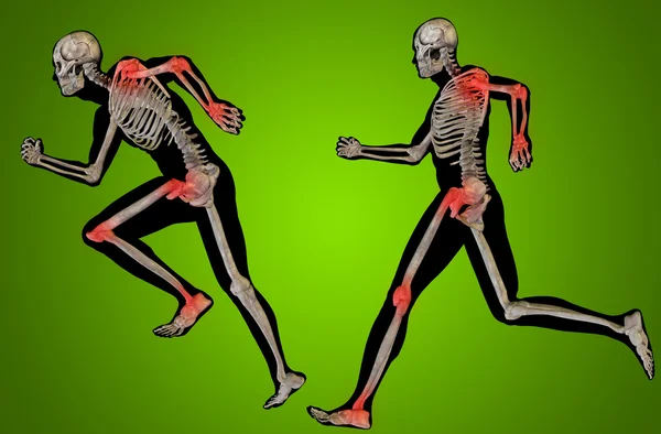 Man or male skeleton pain — Stock Photo, Image