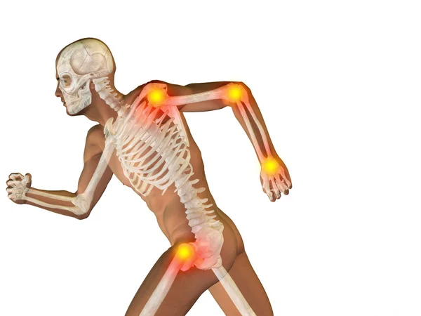 联合或关节疼痛疼痛 — 图库照片
