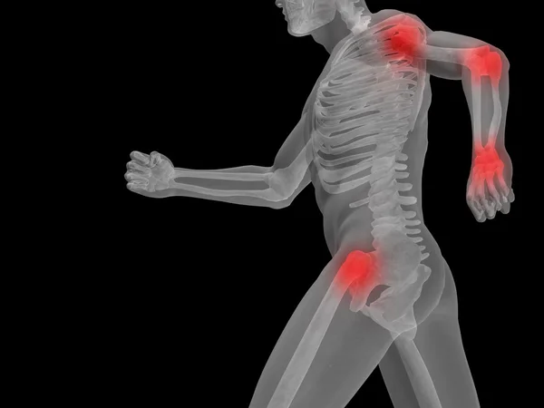 人类与关节或骨骼疼痛 — 图库照片