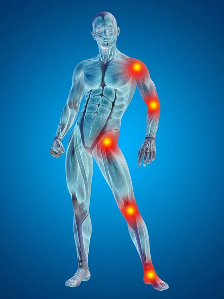 Man  with articular  pain. — Stock Photo, Image