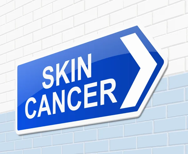 Concept de cancer de la peau . — Photo