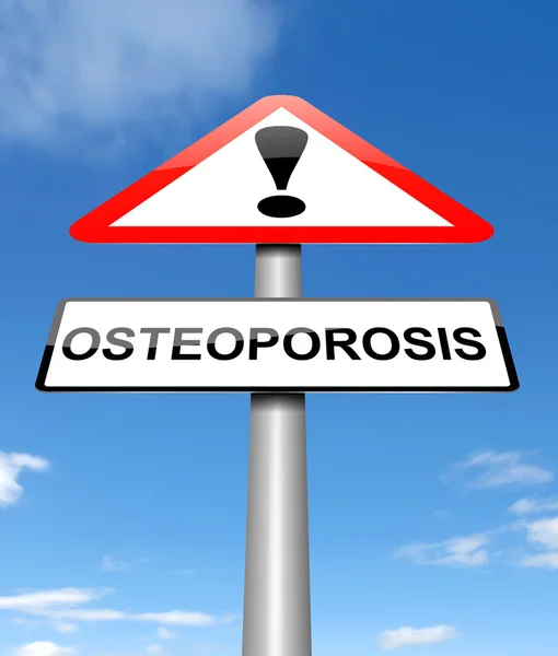 Concepto de osteoporosis . —  Fotos de Stock