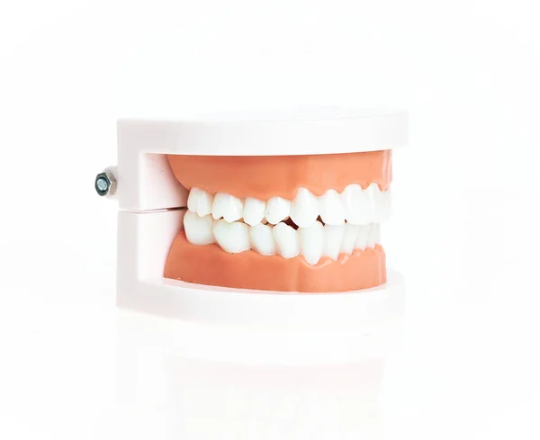 Dentes Artificiais Prótese Sobre Fundo Branco Isolado — Fotografia de Stock