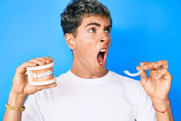 Jeune Homme Beau Tenant Orthodontique Colère Fou Hurlant Frustré Furieux — Photo