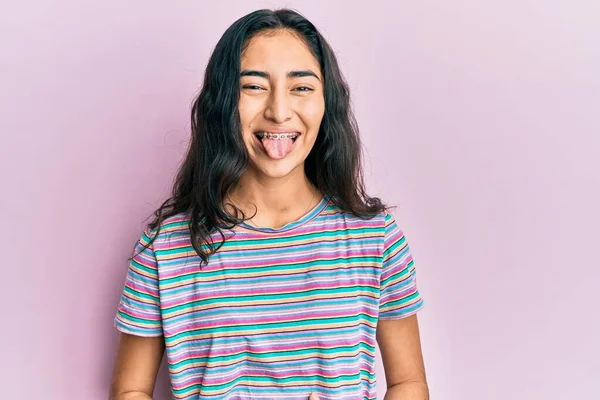 Diş Teli Takan Sıradan Kıyafetler Giyen Komik Bir Ifadeyle Dilini — Stok fotoğraf
