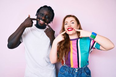 Irklar arası çiftler günlük kıyafetler giyip neşeli bir şekilde gülümsüyor ve parmakları, dişleri ve ağızlarıyla işaret ediyorlar. diş sağlığı kavramı. 