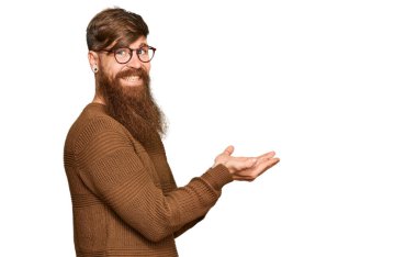 Genç İrlandalı kızıl elbiseli ve gözlüklü bir adam avuçlarını açıp fotokopi alanını gösteriyor. 