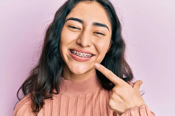 Hispánský Teenager Dívka Zubní Rovnátka Ukazující Ortodontické Závorky Úsměvem Šťastný — Stock fotografie