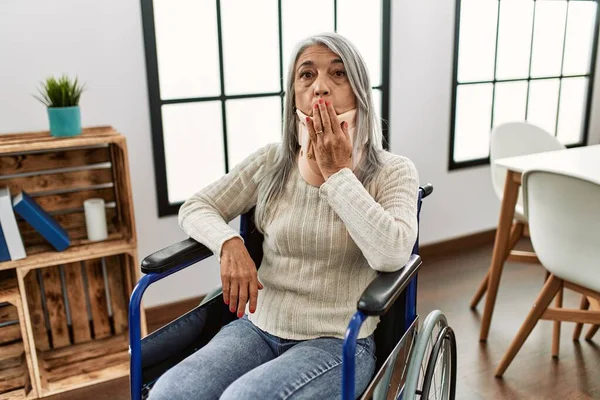 Orta yaşlı, gri saçlı, tekerlekli sandalyede oturan, tasmalı, ağzı elle kaplanmış, şok olmuş ve hata yapmaktan korkan bir kadın. şaşırmış ifade 