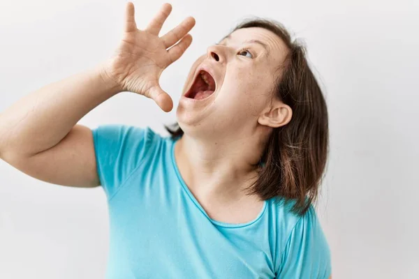 Genç Sendromlu Kadın Arka Planda Durmuş Ele Tutuşarak Bağırıyor Çığlık — Stok fotoğraf