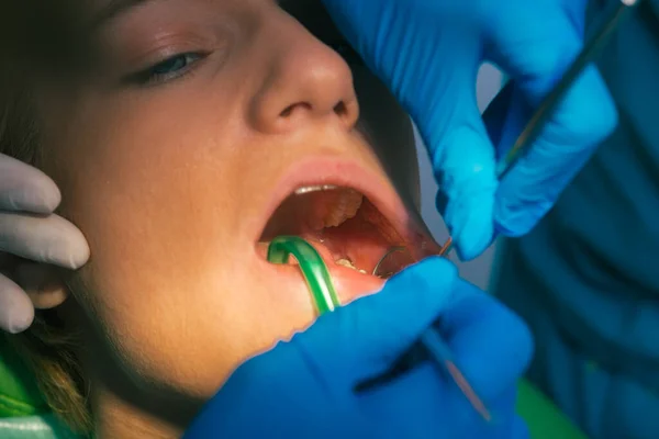 Closeup clean dental examination on a woman\'s teeth in a dental office