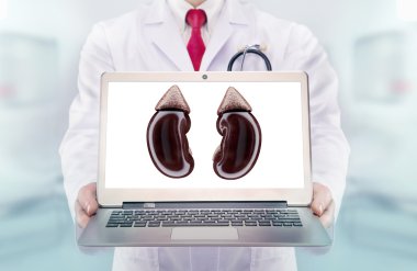 Doktor stetoskop bir hastanede ile. Böbrekler üzerinde laptop monitör