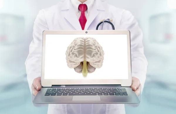 Doutor com estetoscópio em um hospital. Cérebro no monitor do laptop — Fotografia de Stock