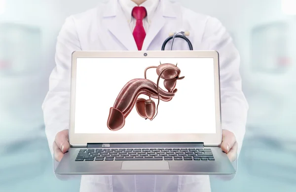 Dokter dengan stetoskop di rumah sakit. penis pada monitor laptop — Stok Foto