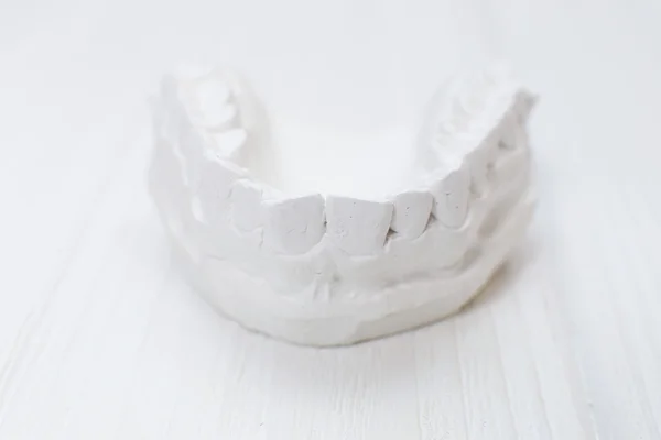 Close-up individual tooth tray Orthodontic dental theme. Invisible braces — Stock Photo, Image