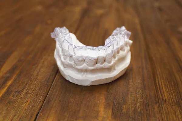 Närbild enskild tand bricka Tandregleringstjänster tand tema. Osynlig tandställning — Stockfoto