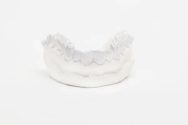 Nahaufnahme individuelle Zahntablett kieferorthopädischen Zahnthema. unsichtbare Zahnspangen — Stockfoto