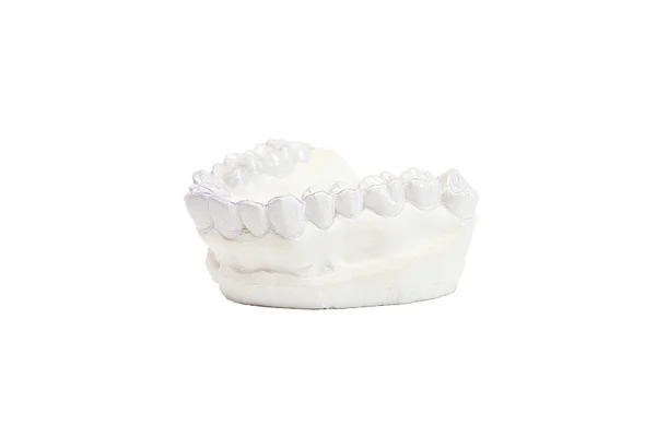 Close-up individual tooth tray Orthodontic dental theme. Invisible braces — Stock Photo, Image