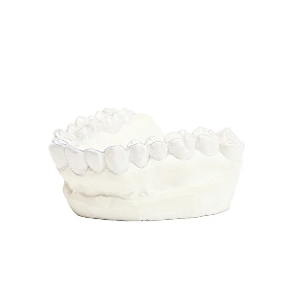 Nahaufnahme individuelle Zahntablett kieferorthopädischen Zahnthema. unsichtbare Zahnspangen — Stockfoto