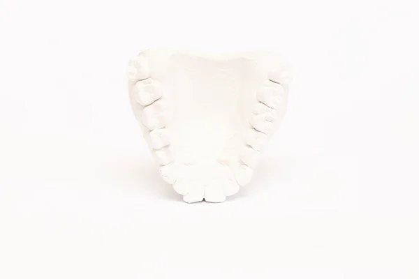 Close-up individual tooth tray Orthodontic dental theme. Invisible braces — Stock Photo, Image